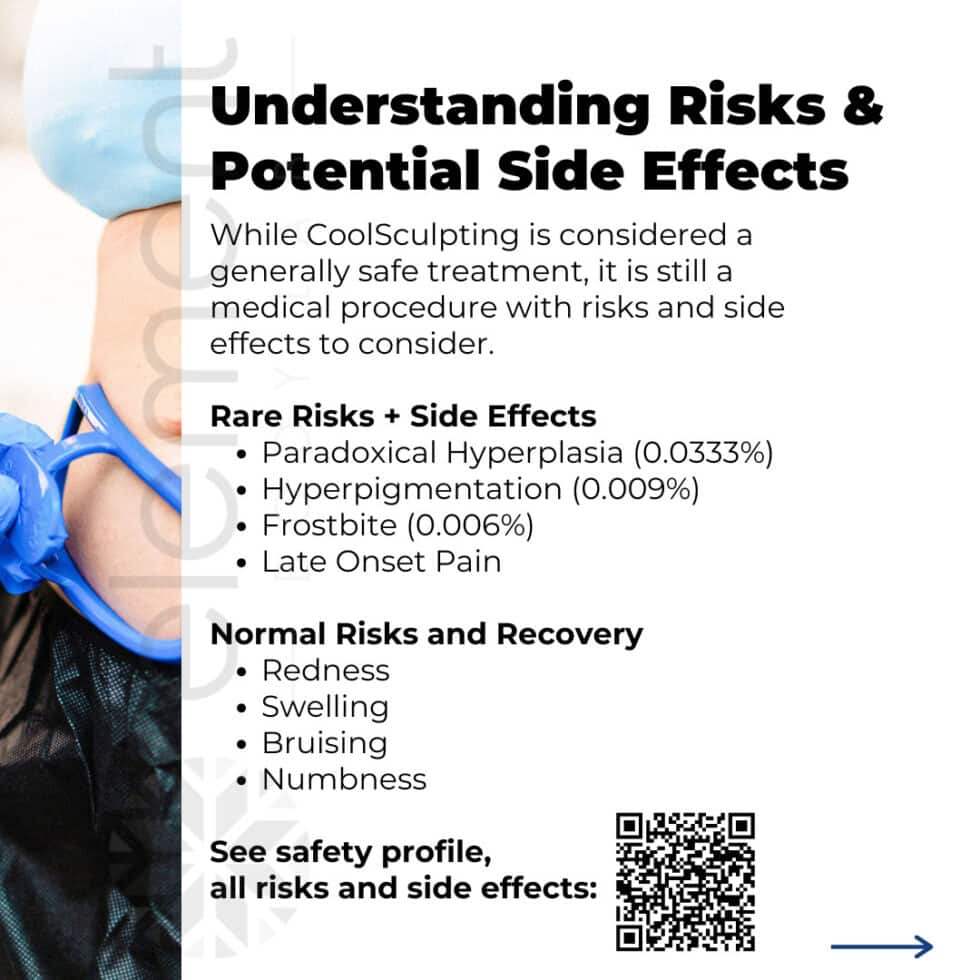 CoolSculpting Side Effects: Understanding The Risks After Linda Evangelista's Case CoolSculpting Side Effects: Understanding The Risks After Linda Evangelista's Case