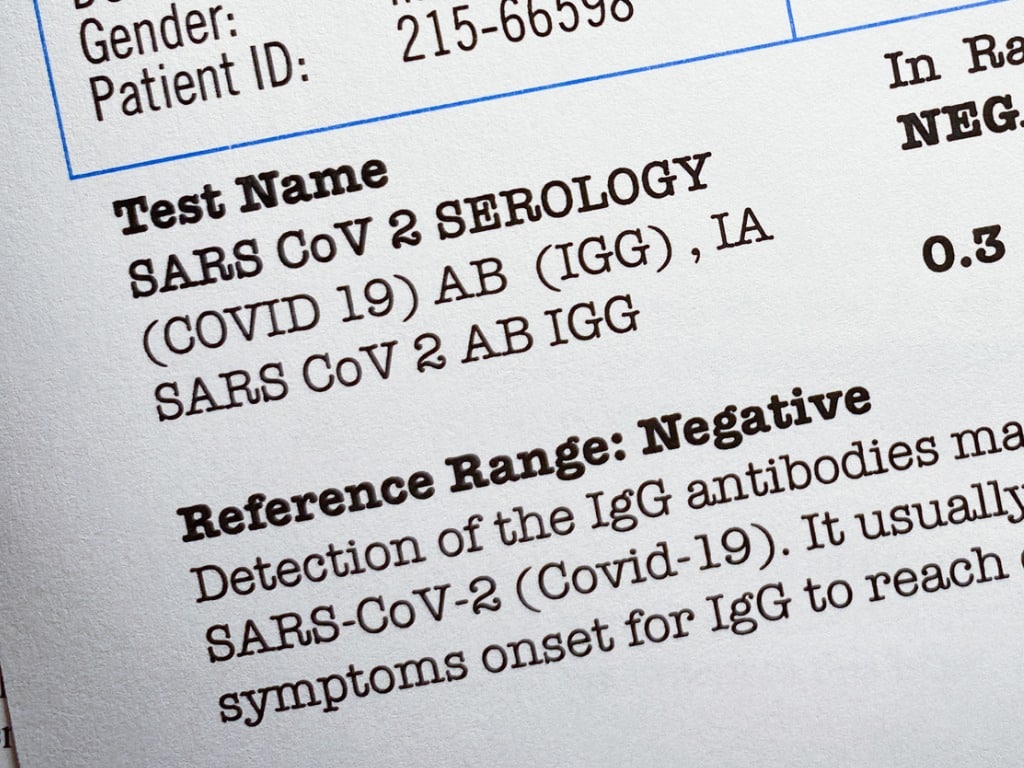 Pandemic Fraud: Lab Owner Pleads Guilty To Fake COVID Test Results Pandemic Fraud: Lab Owner Pleads Guilty To Fake COVID Test Results